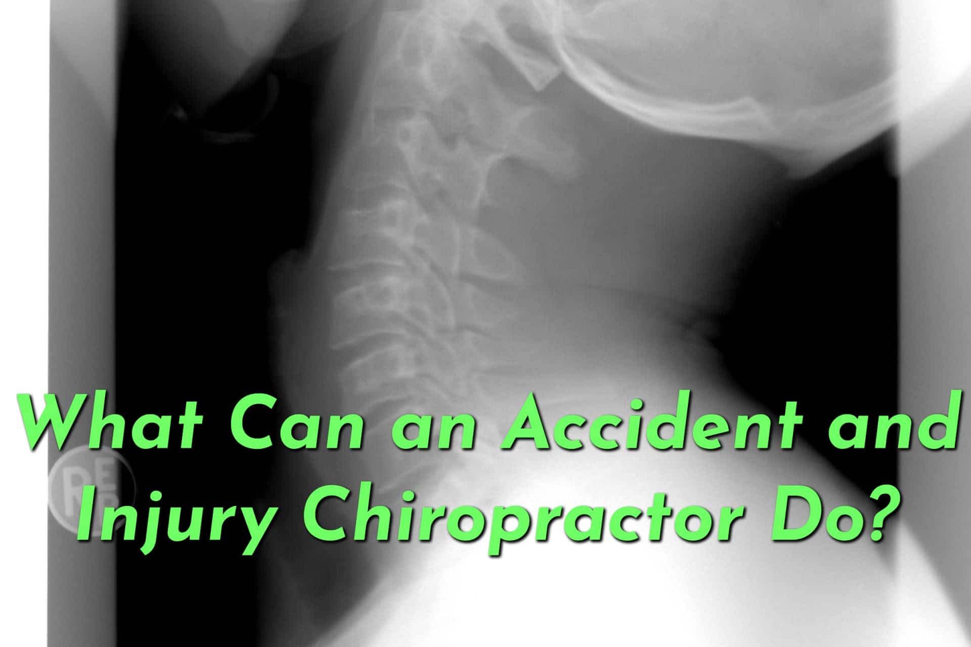 A neck x-ray taken by an accident and injury chiropractor